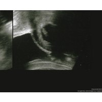 Starving Hysterical Naked 7 Inch - Palm Honey